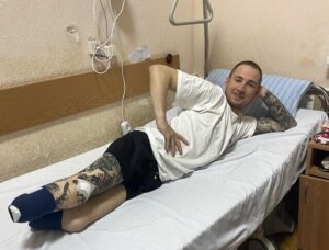 “Я можу себе обслуговувати, мені не треба пелюшки приносити, рот витирати”: як Терен живе після ампутації обох ніг